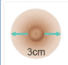 3 cm Areolas